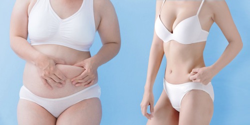 太っている女性と痩せている女性のお腹の比較をしている画像