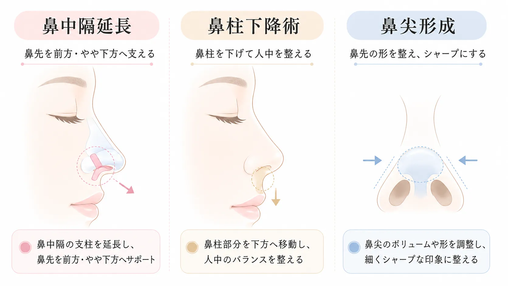 各施術の違い