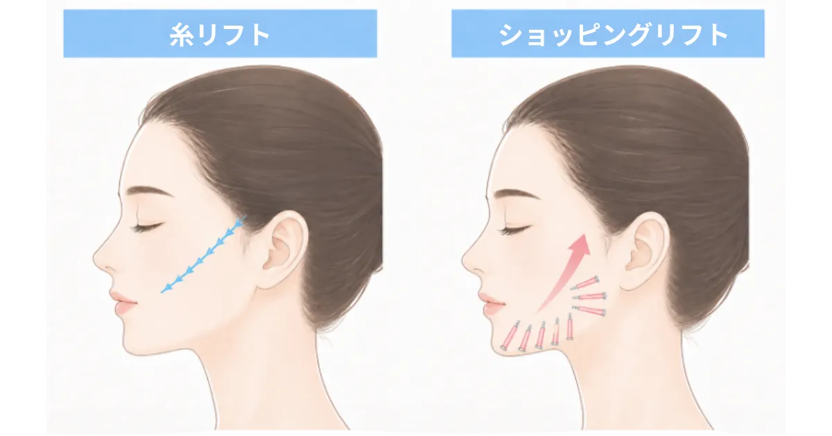 糸リフトとショッピングリフトの違い