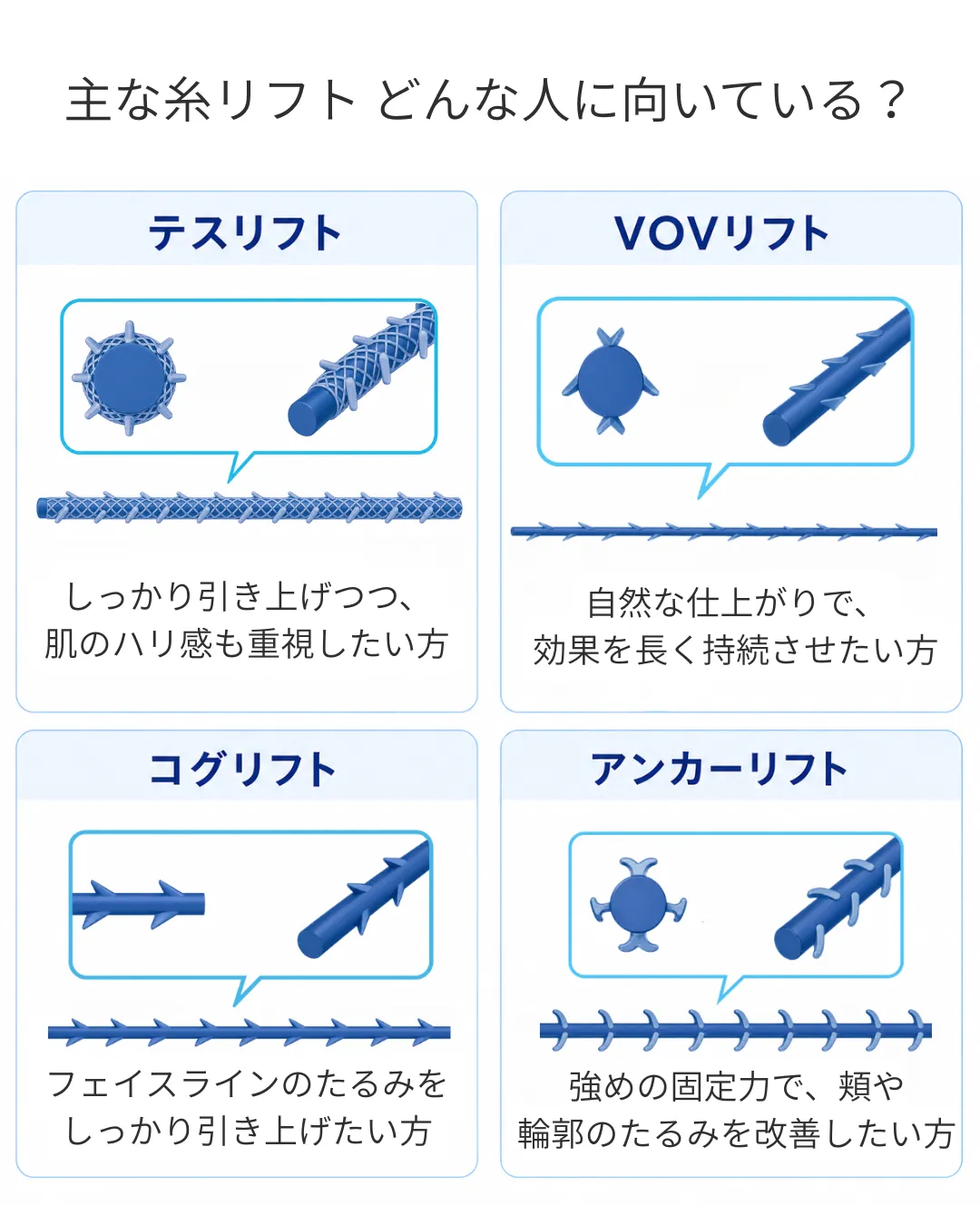 主な糸リフトの種類