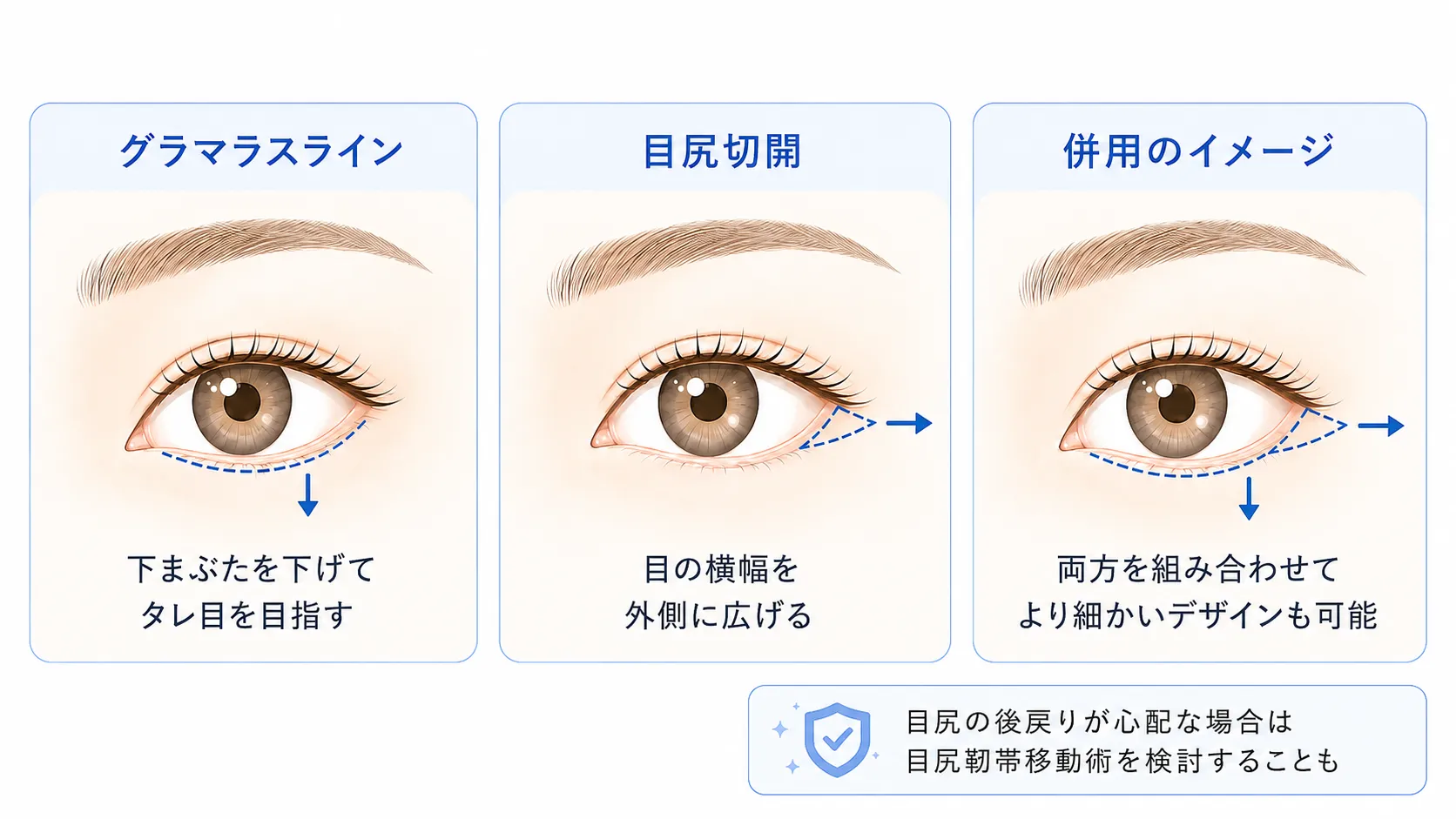グラマラスラインと目尻切開の違い