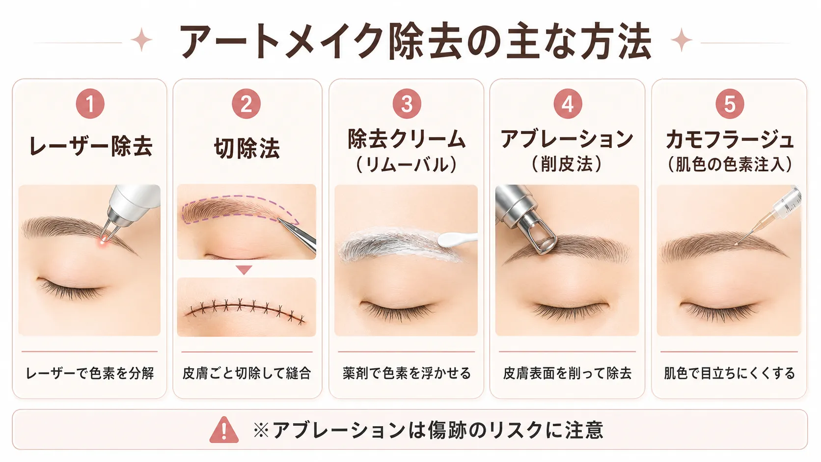 アートメイク除去方法の各施術説明画像