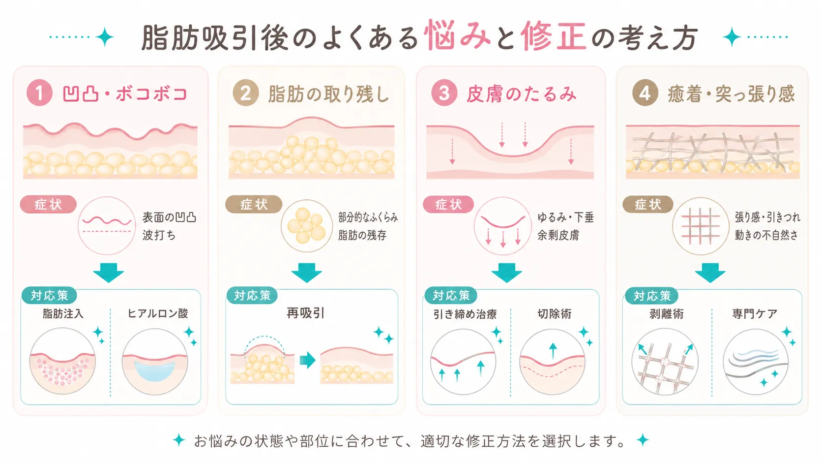 脂肪吸引後のよくある悩みと修正の考え方