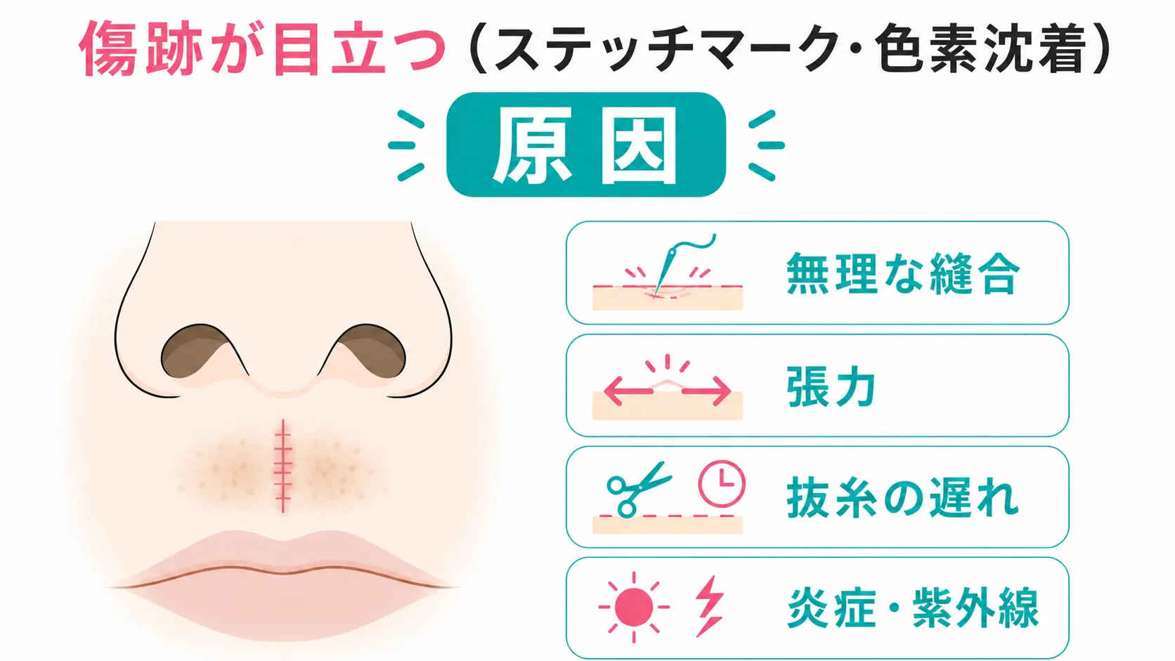 小鼻縮小修正│傷跡の症状と原因イラスト