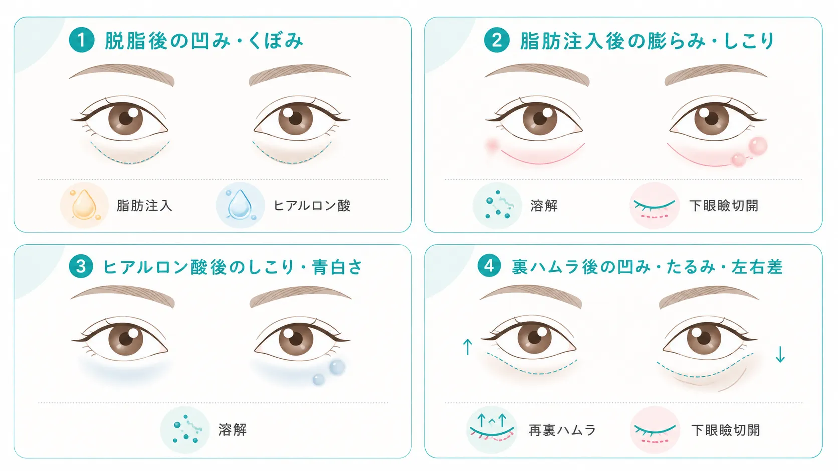 クマ取り他院修正で検討される治療法