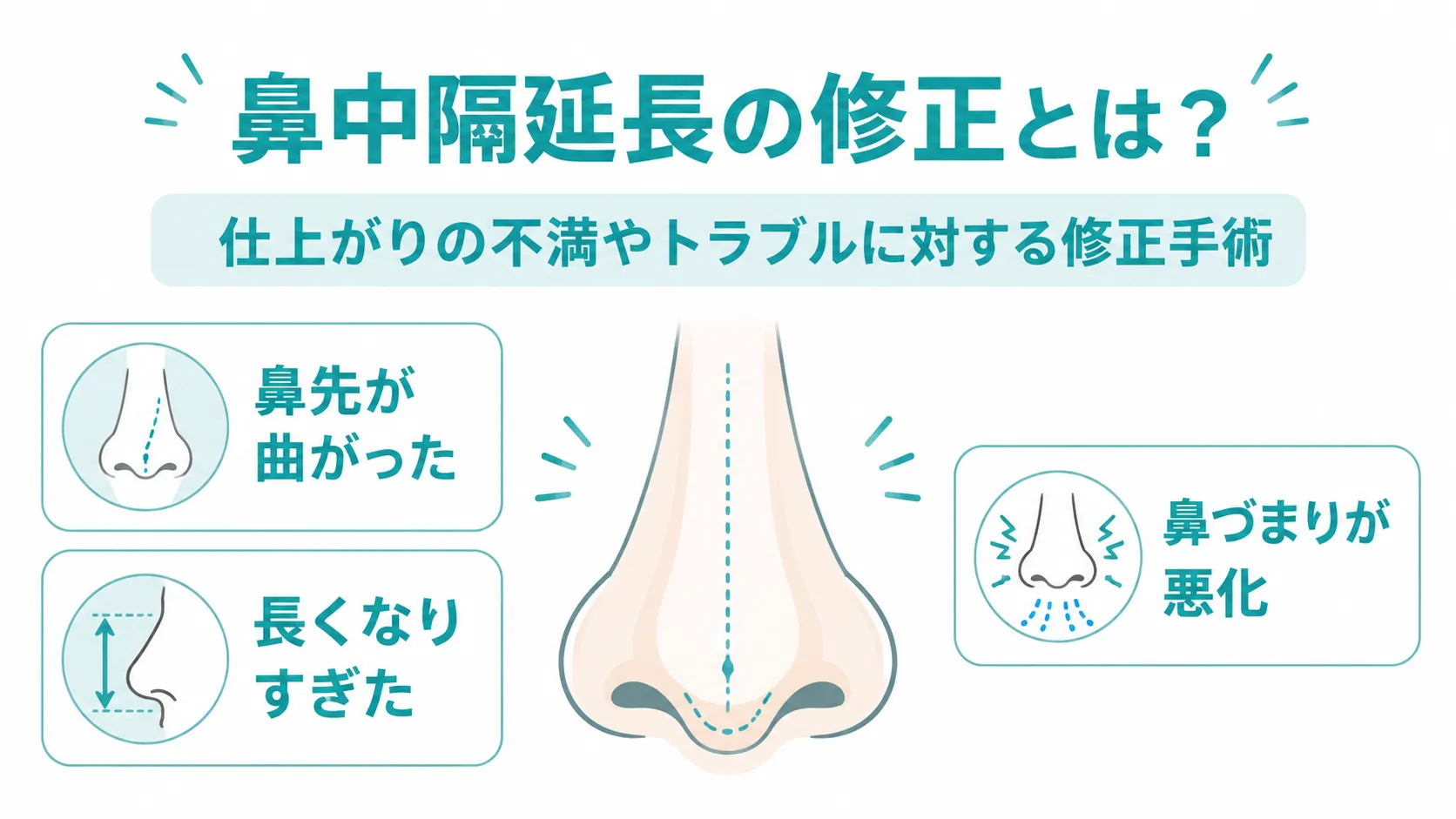鼻中隔延長の修正手術説明画像