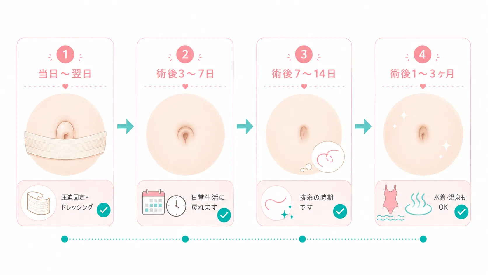 でべそ修正術後回復の進行タイムライン