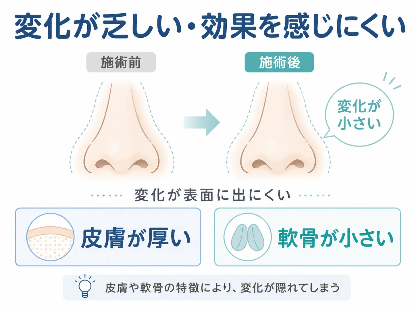鼻尖形成の修正│状態のイラスト(変化が乏しかった・思ったより効果がなかった)