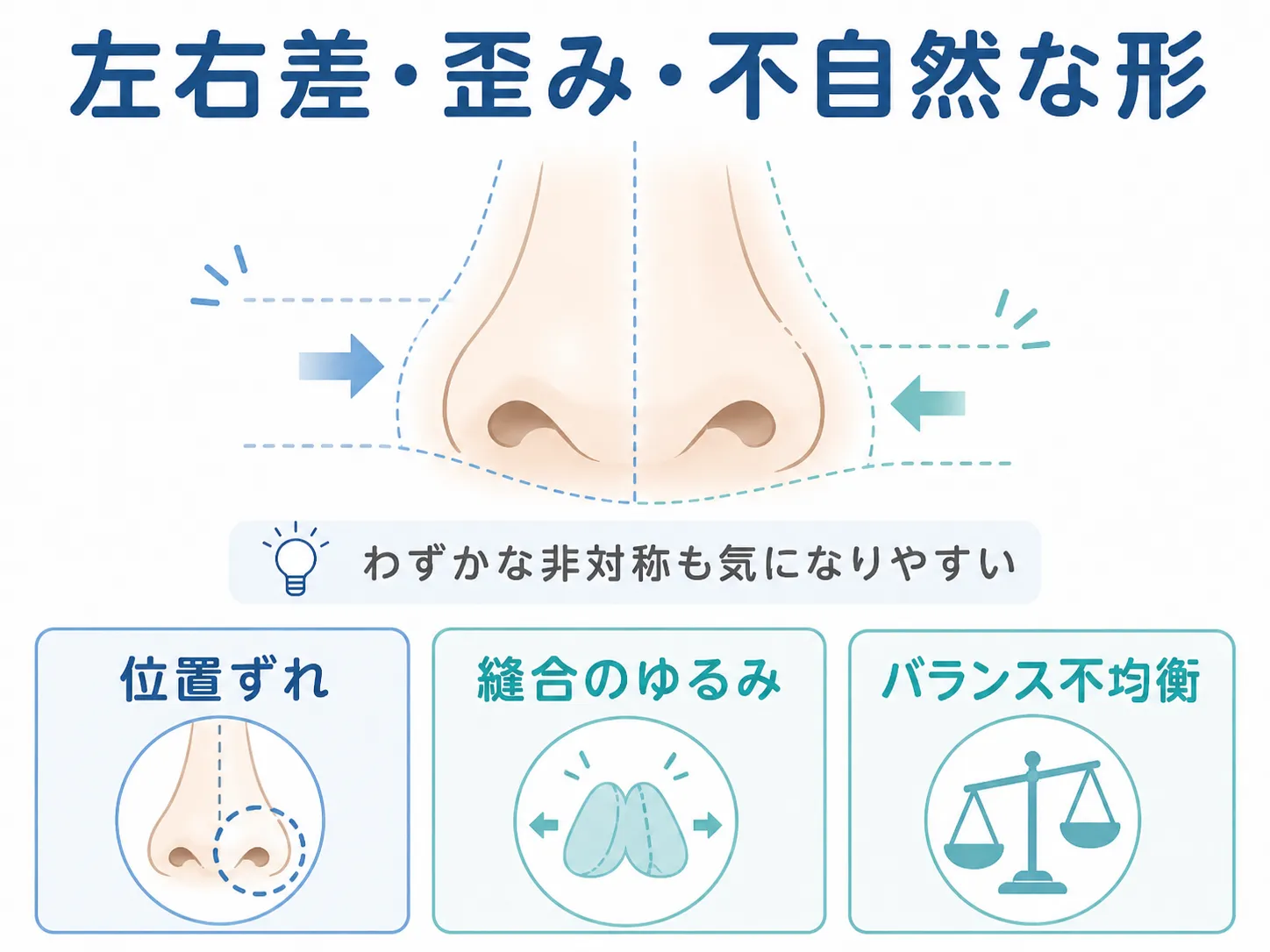 鼻尖形成の修正│状態のイラスト(左右差・歪み・不自然な形になった)