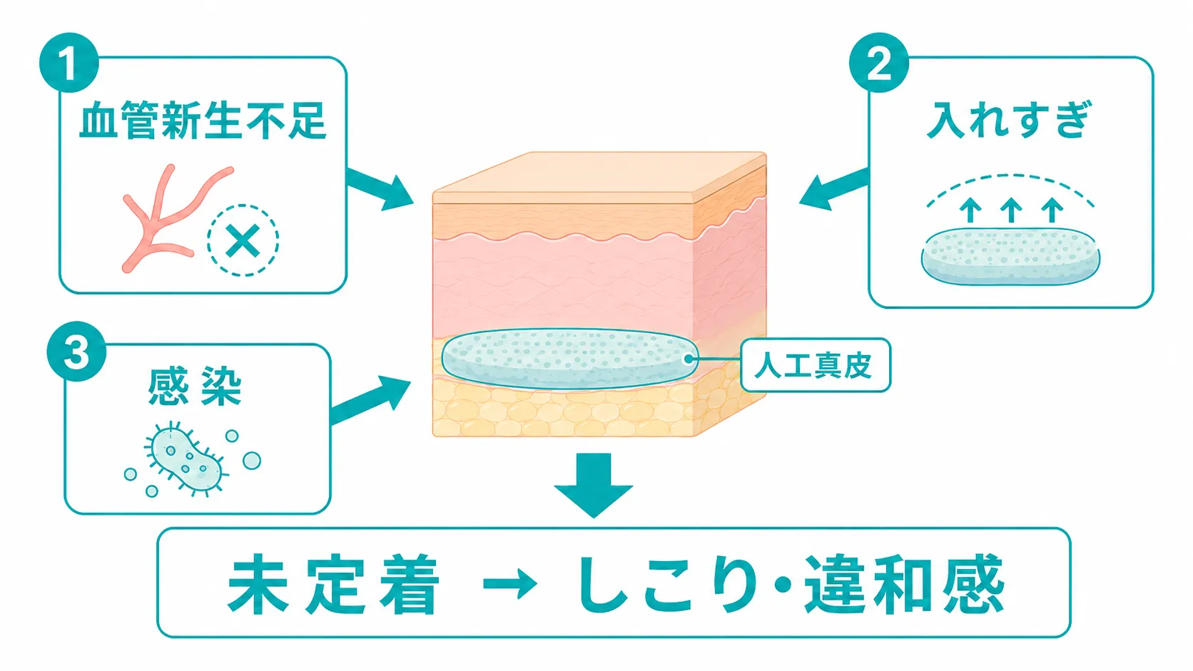 人工真皮を入れた後にしこりや違和感が出る原因のアイキャッチ画像