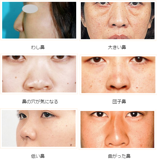 インタビュー 大塚美容形成外科で人気の石井医師に鼻整形について聞いてみました